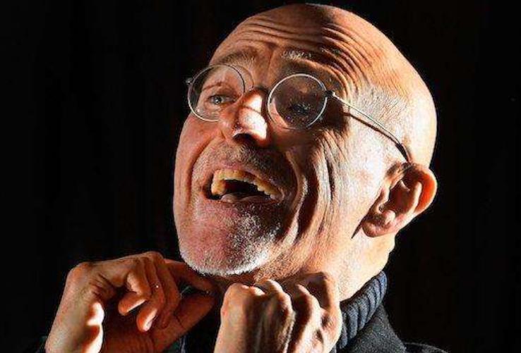 醫學奇跡再現，換頭手術最新消息揭秘！