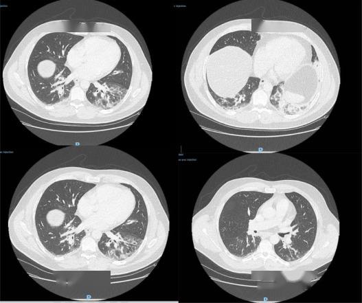 法國病毒最新,一場意外的溫馨之旅探索