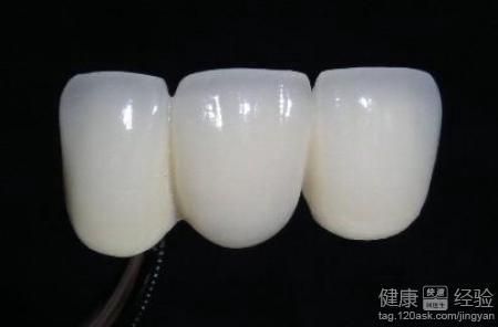 烤瓷牙和全瓷牙價格,探索學(xué)習(xí)與變化的魅力之旅