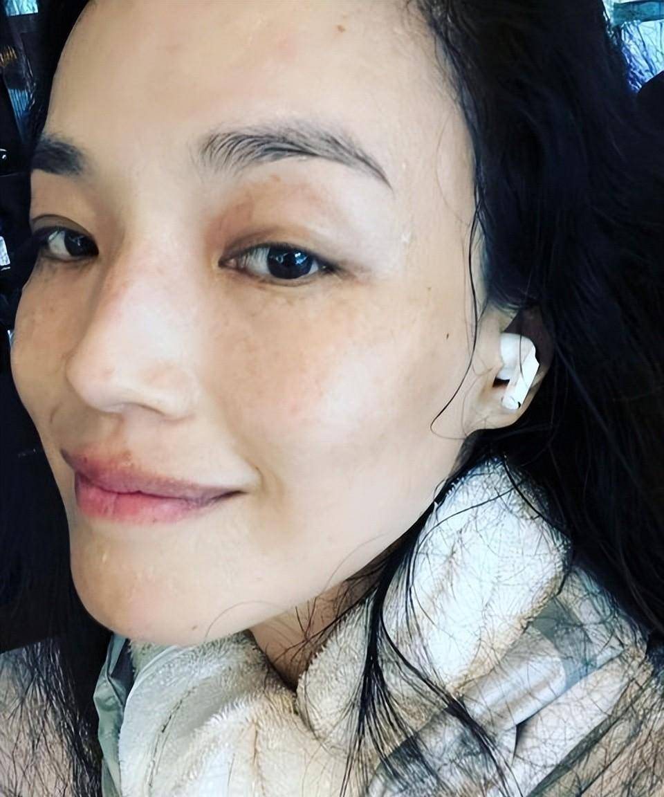 審美多元下的獨特魅力,雀斑明星的自信風采