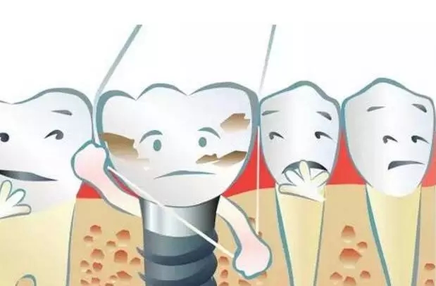 最新防蛀牙技術(shù)，守護您的燦爛笑容